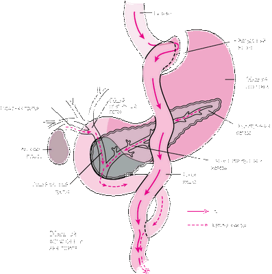 Длительное шунтирование желудка, связанное с более высокой скоростью ремиссии диабета