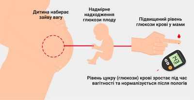 Лечение даже легкой степени гестационного диабета снижает риск родовых осложнений (с видео)