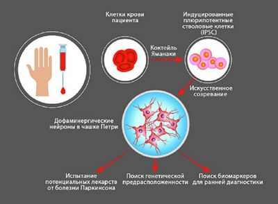 Стволовые клетки матки создают новые нейроны, которые могут обуздать болезнь Паркинсона